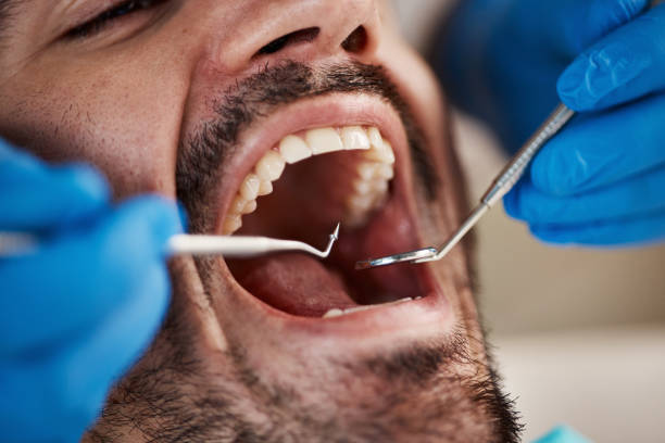 Best Urgent Dental Care for Toothache in Beresford, SD